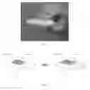 Fig. 02 - Method of treating epilepsy