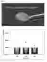 Fig. 02 - NOVEL STEM CELL CARRIER AND METHOD FOR PREPARING THE SAME