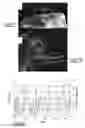 Fig. 22 - Delivery devices and methods for making the same