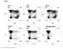 Fig. 07 - Chimeric antigen receptor and CAR-T cells that bind BCMA