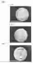 Fig. 02 - Cell preparation for treating cartilage tissue-related disorder