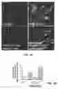 Fig. 07 - Methods for treatment of and prophylaxis against inflammatory disorders
