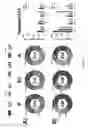 Fig. 33 - Pneumococcal vaccine formulations