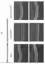 Fig. 25 - COMPOSITIONS AND METHODS FOR TREATING MACULAR DYSTROPHY