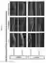 Fig. 27 - COMPOSITIONS AND METHODS FOR TREATING MACULAR DYSTROPHY