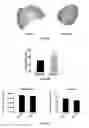 Fig. 04 - Cartilage material having minimal hypertrophy and robust integration capacity, and uses therefor