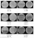 Fig. 09 - POLYMERIC PATCH SCAFFOLDS FOR ARTICULAR CARTILAGE REGENERATION