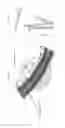 Fig. 04 - Method and apparatus for a stent with a capped-release mechanism (CRM)
