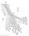 Fig. 04 - Adaptable wound drainage system