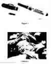 Fig. 02 - Surgical system and method of use