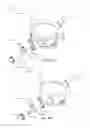 Fig. 35 - Blood pump systems and methods
