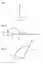Fig. 02 - Access cannula comprising blocking device
