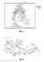 Fig. 05 - Vascular isolation systems and methods