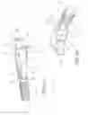 Fig. 07 - Needle stick protection device