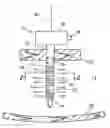 Fig. 01 - Trocar Sleeve