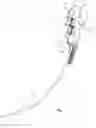 Fig. 02 - Endotracheal tube-inserting device