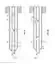 Fig. 04 - Introducer needle with notches for improved flashback