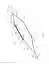 Fig. 03 - Cutting balloon basket