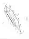 Fig. 04 - Cutting balloon basket