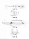 Fig. 02 - Low Profile Balloon Catheter And Related Systems And Methods