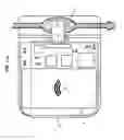 Fig. 10 - Device for detecting a malfunctioning of a ventriculoperitoneal shunt for cerebrospinal fluid