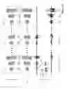 Fig. 09 - System to estimate the location of a spinal cord physiological midline