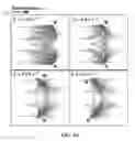 Fig. 08 - Rheotaxis-based separation of motile sperm and bacteria using a microfluidic corral system