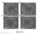 Fig. 09 - Rheotaxis-based separation of motile sperm and bacteria using a microfluidic corral system