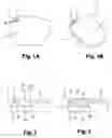 Fig. 02 - Process for marking an optical eyeglass