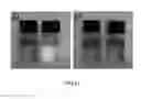 Fig. 06 - Iron-based amorphous electrode material for wastewater treatment and use thereof