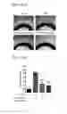 Fig. 16 - DEGLYCOSYLATED ANTIBODY SPECIFICALLY BINDING TO CLEC14A AND USES THEREOF