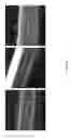 Fig. 06 - COATING METHOD AND PRODUCT THEREOF