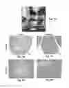 Fig. 08 - Three Dimensional Bioprinted Tumor Models for Drug Testing