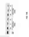 Fig. 16 - Compositions and Methods for Inhibiting Expression of Transthyretin