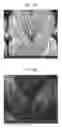 Fig. 06 - PROCESS OF MAKING TEXTURED MULTICOMPONENT FIBERS