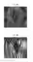 Fig. 05 - PROCESS OF MAKING TEXTURED MULTICOMPONENT FIBERS