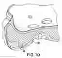 Fig. 09 - Additive manufacturing controlled failure structure and method of making same
