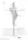 Fig. 02 - Well bit assembly