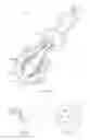 Fig. 02 - SOFT CONFORMAL LAPAROSCOPIC INSTRUMENT