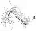 Fig. 02 - Ligation clip with latching and retention features