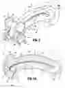 Fig. 03 - Ligation clip with latching and retention features