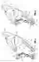 Fig. 08 - Ligation clip with latching and retention features