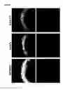 Fig. 22 - Gene therapy