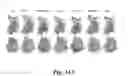 Fig. 49 - Tumor and immune cell imaging based on PD-L1 expression
