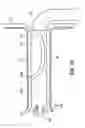 Fig. 35 - SYSTEM AND METHOD FOR ENDOLUMINAL AND TRANSLUMENAL THERAPY