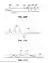 Fig. 45 - SYSTEM AND METHOD FOR ENDOLUMINAL AND TRANSLUMENAL THERAPY