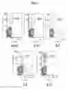 Fig. 04 - Methods of using IL-21 for adoptive immunotherapy and identification of tumor antigens