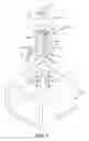 Fig. 04 - Fastener assembly for use with one or more workpieces