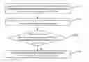 Fig. 01 - Document processing method and device