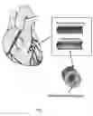 Fig. 02 - Method and system for assessing vessel obstruction based on machine learning